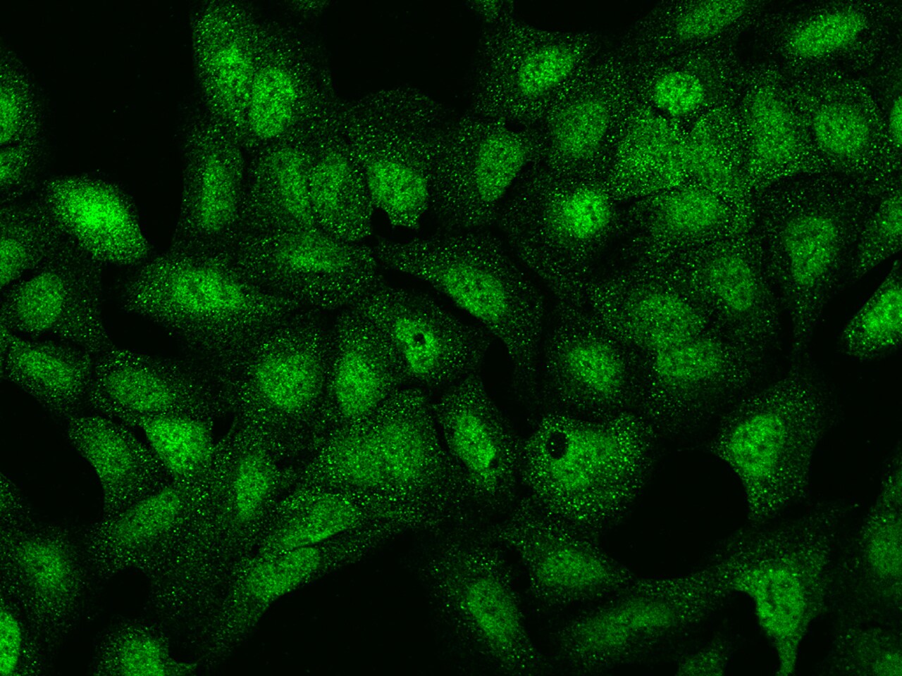LRWD1 Antibody - BSA Free