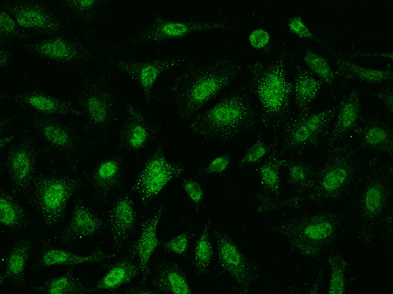 AMMECR1 Antibody - BSA Free