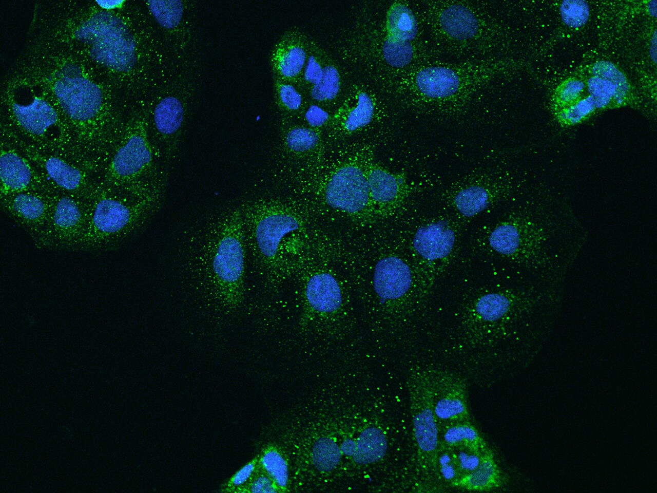 CLCN2 Antibody - BSA Free