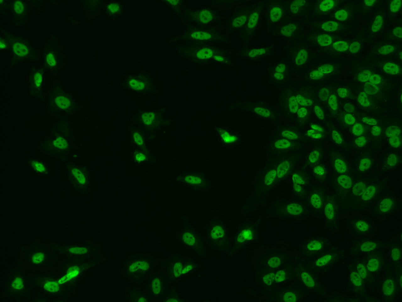 CTDSP2 Antibody - BSA Free