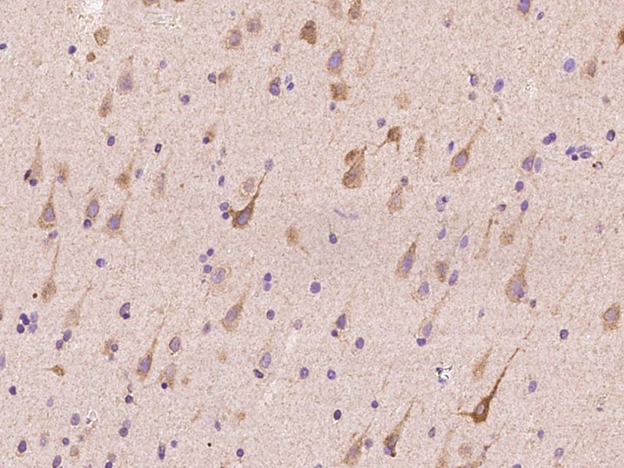 Derlin 1 Antibody - BSA Free