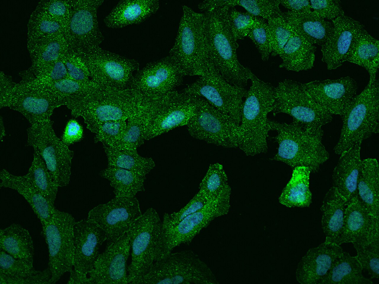 PPP1R18 Antibody - BSA Free