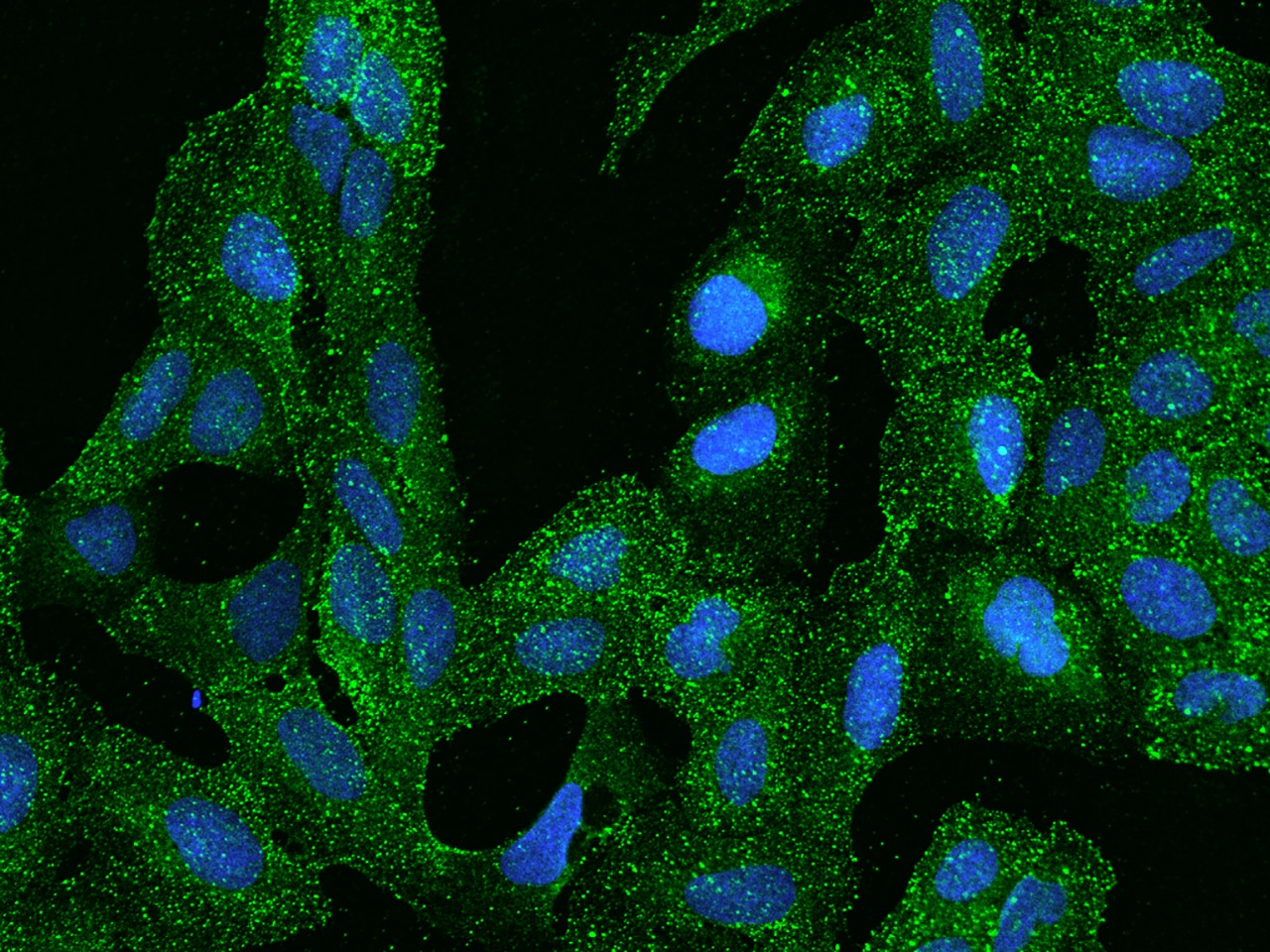 ARHGAP17 Antibody - BSA Free