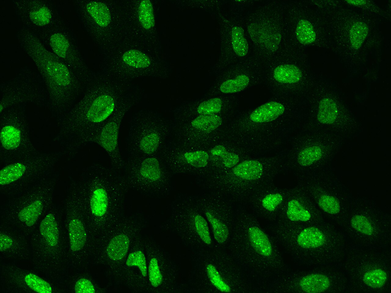 SP100 Antibody - BSA Free
