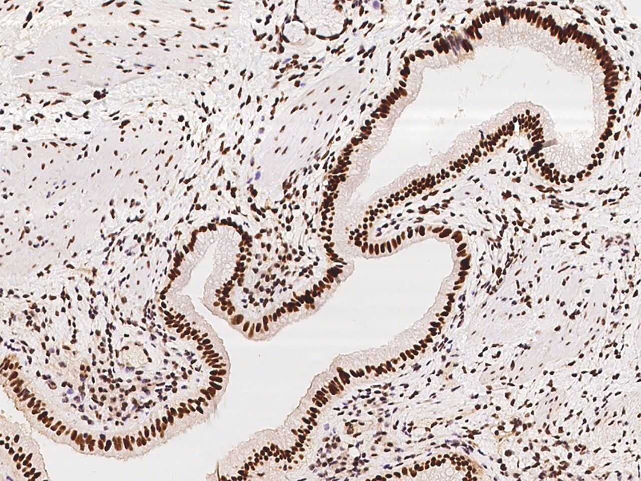 SP100 Antibody - BSA Free