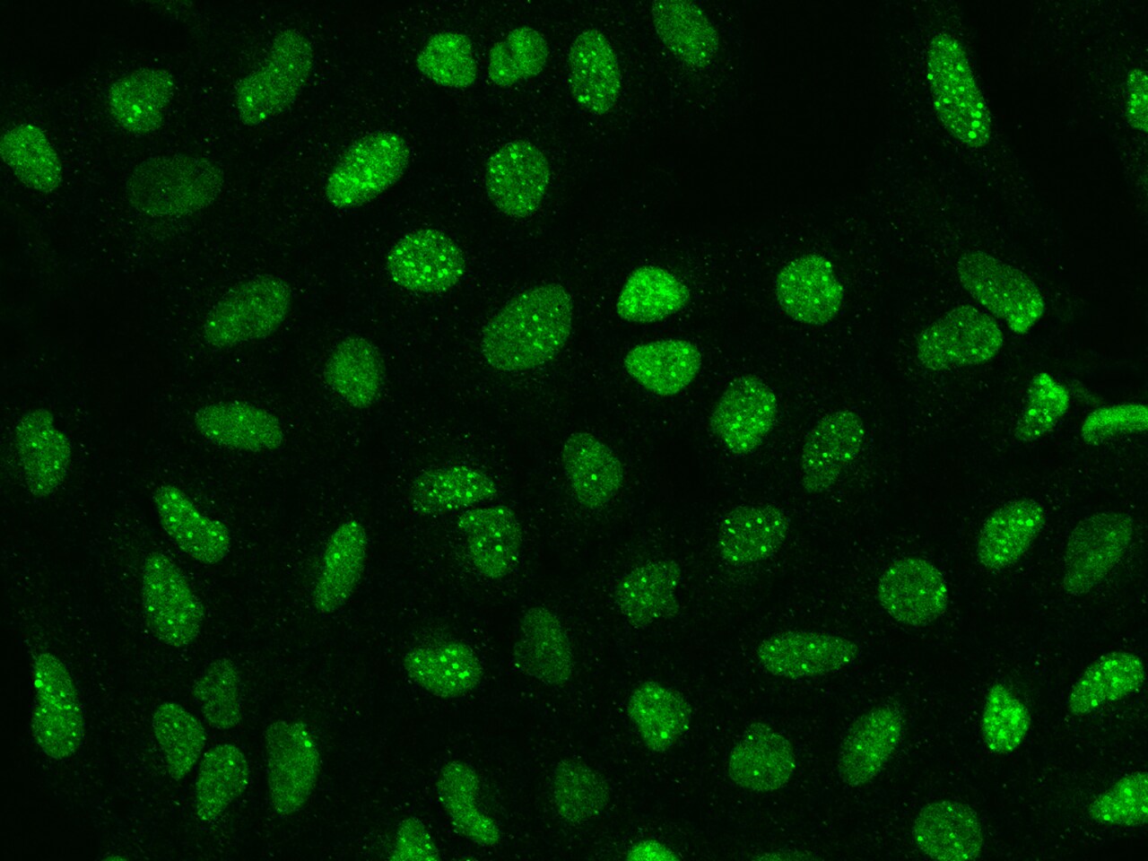 SP100 Antibody - BSA Free