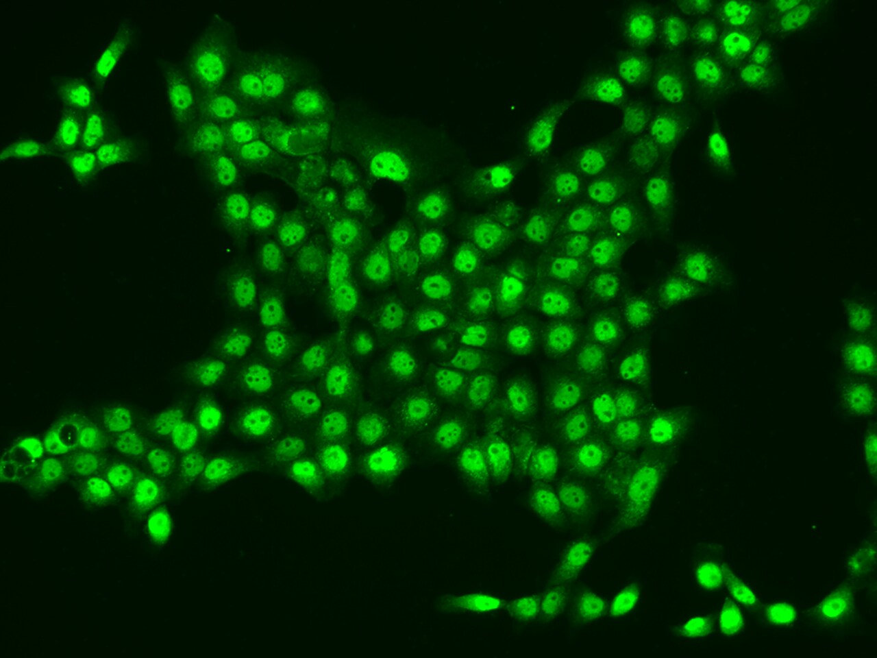 CYTIP Antibody - BSA Free
