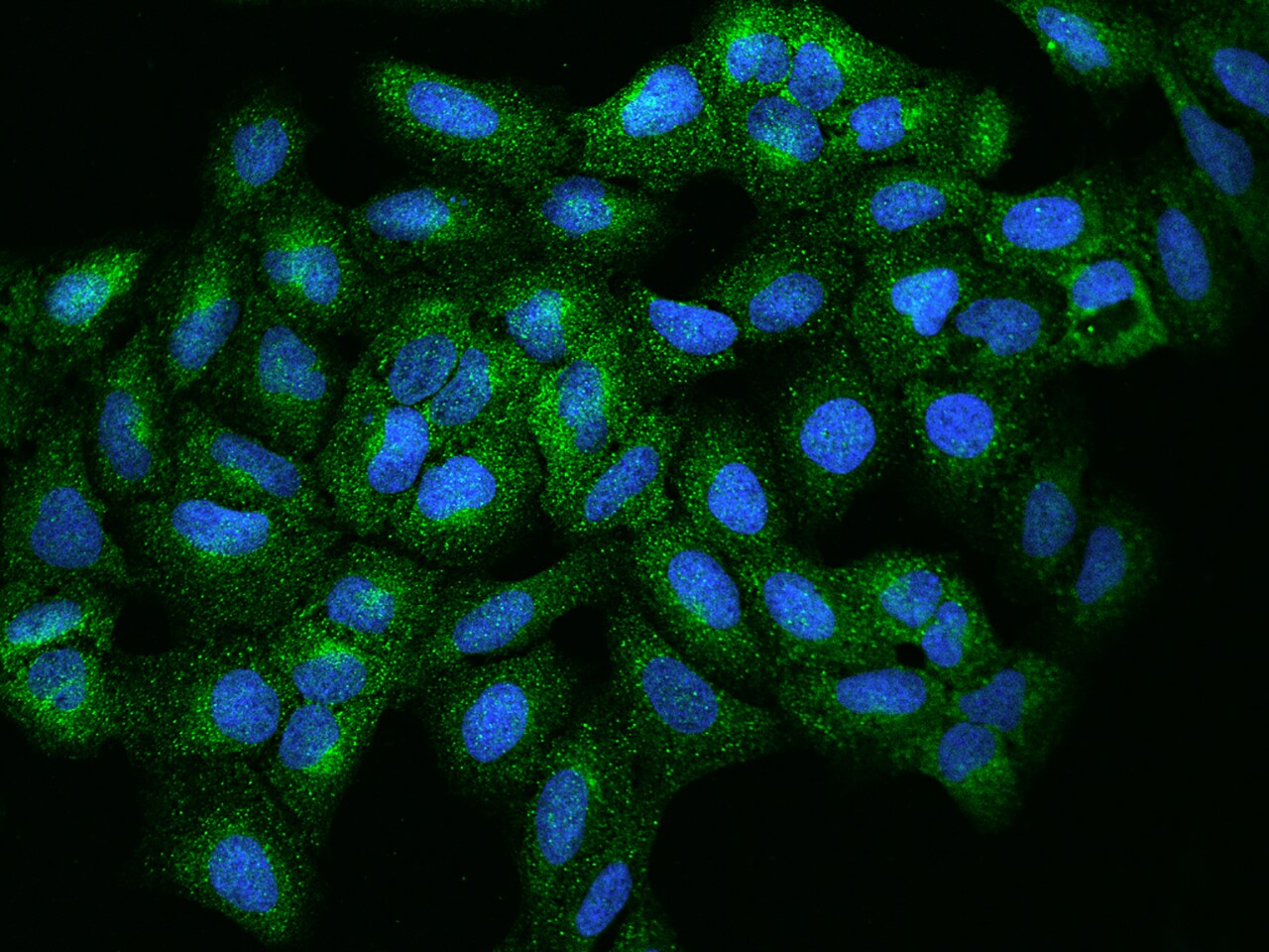 RPIP8 Antibody - BSA Free