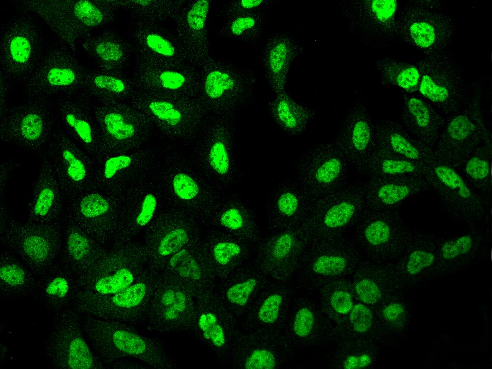 Zeta Opioid Receptor Antibody - BSA Free
