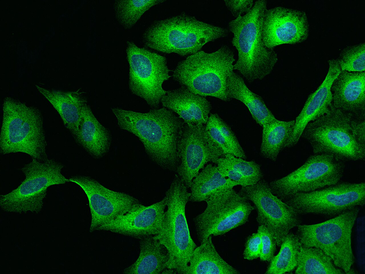 LRRC8B Antibody - BSA Free