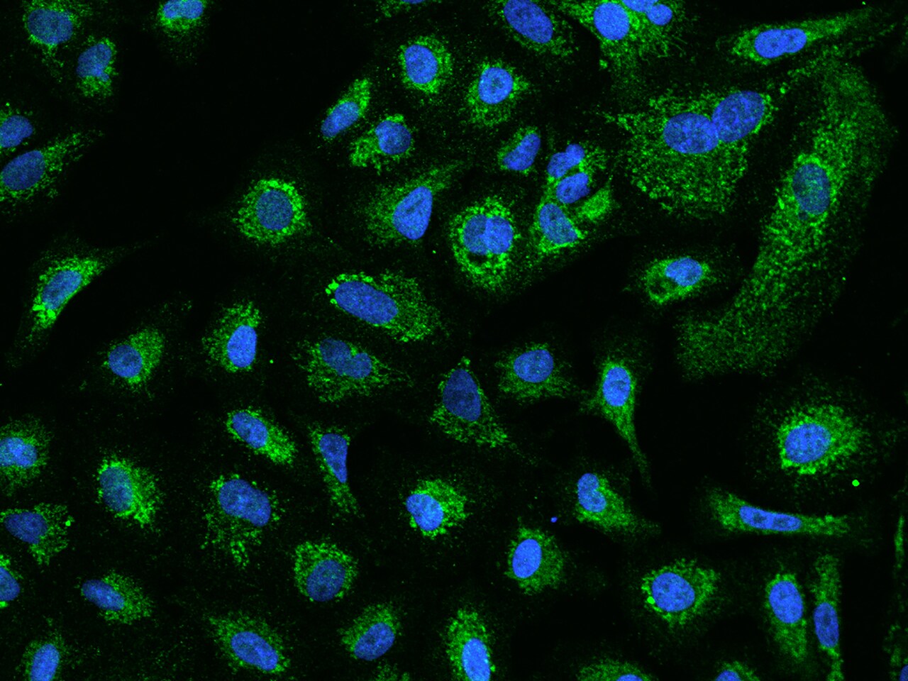 ACADVL Antibody - BSA Free