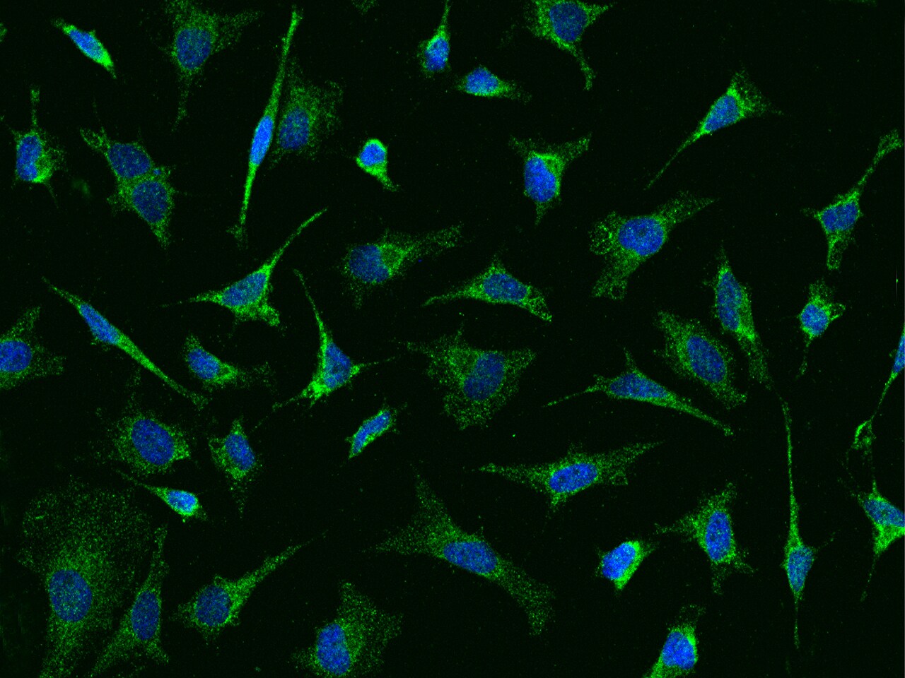 BCKDHA Antibody - BSA Free