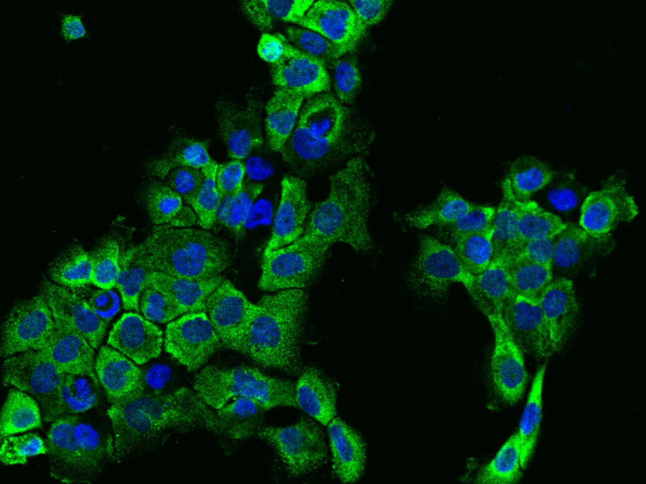 IFT122 Antibody - BSA Free