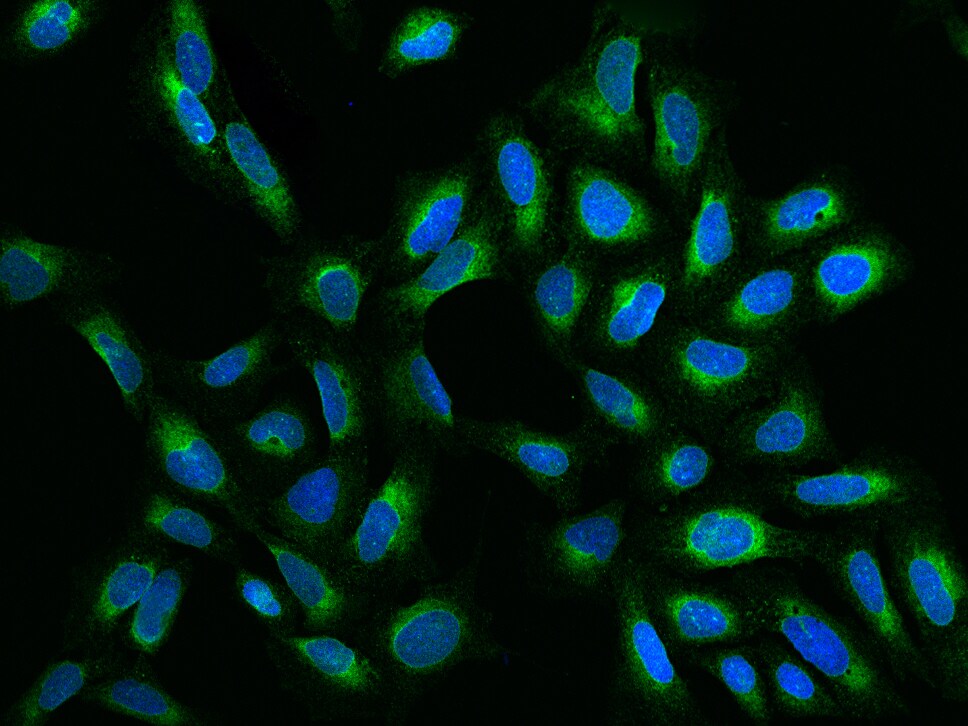 ELOVL5 Antibody - BSA Free