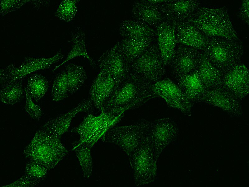 DDX59 Antibody - BSA Free
