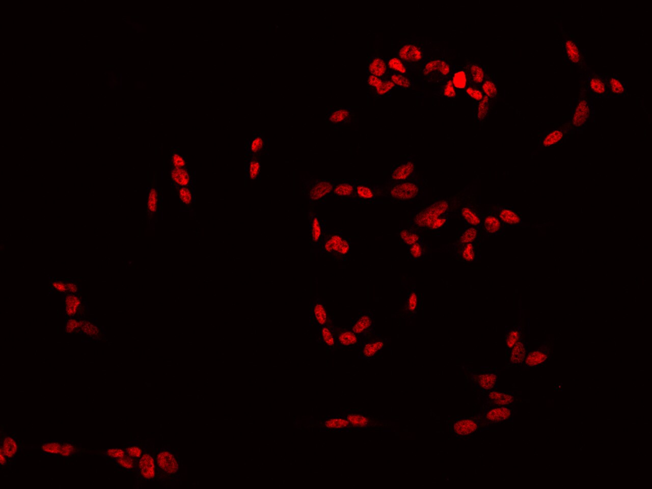 Dlx6 Antibody - BSA Free