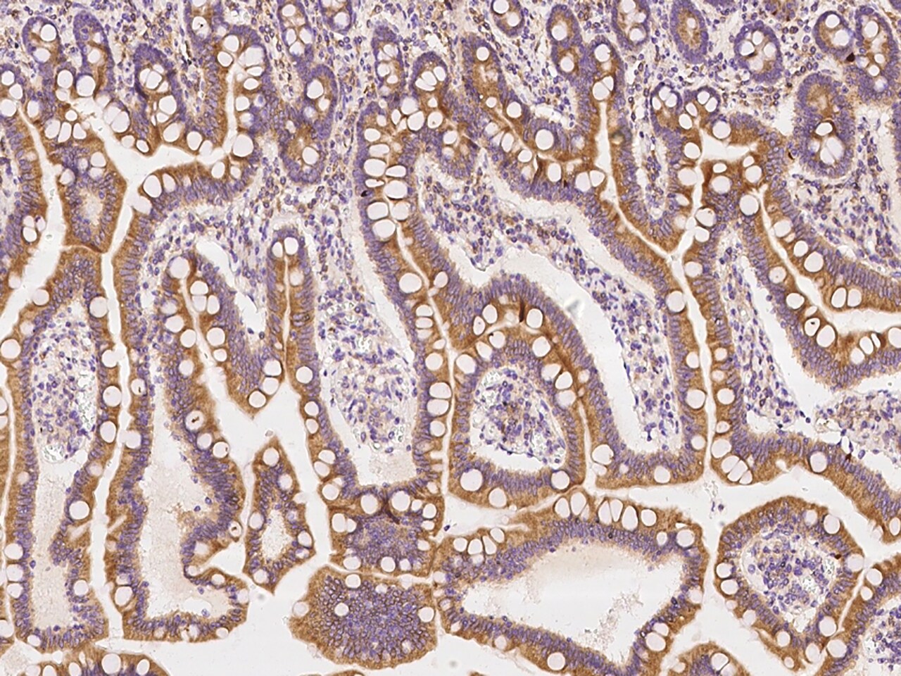 Use1/UBE2Z Antibody - BSA Free