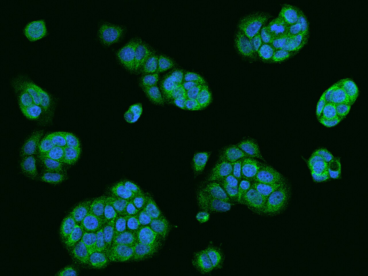 Use1/UBE2Z Antibody - BSA Free