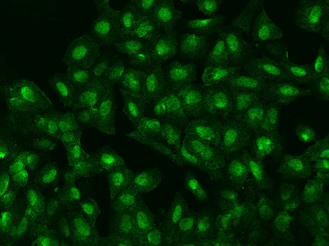 ZFP64 Antibody - BSA Free