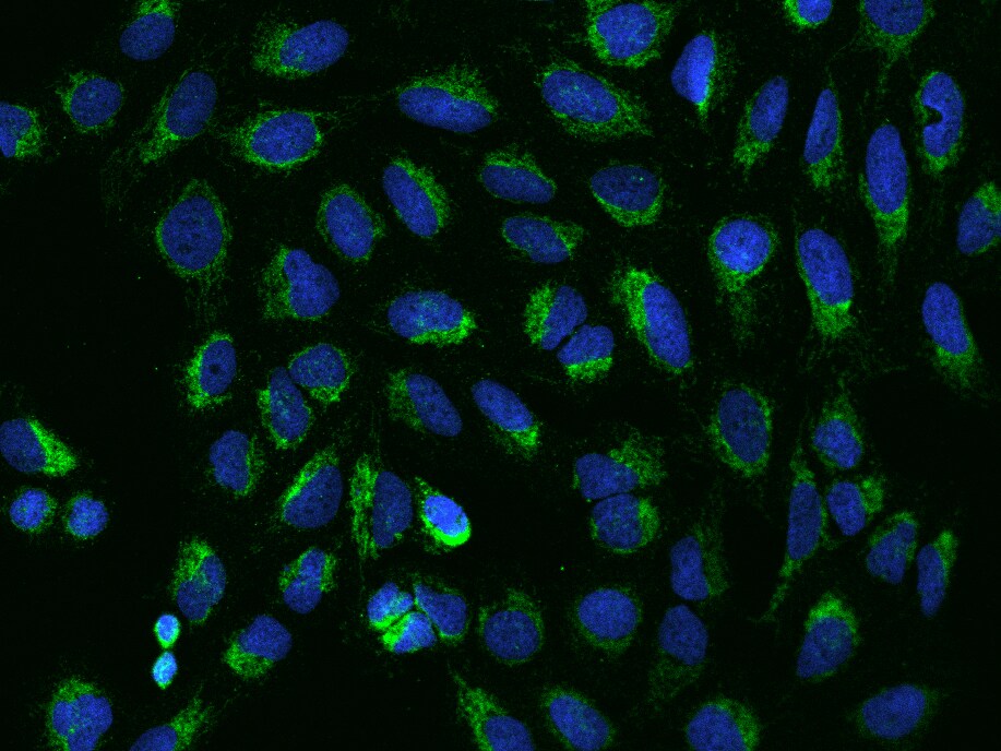 VDAC2 Antibody - BSA Free