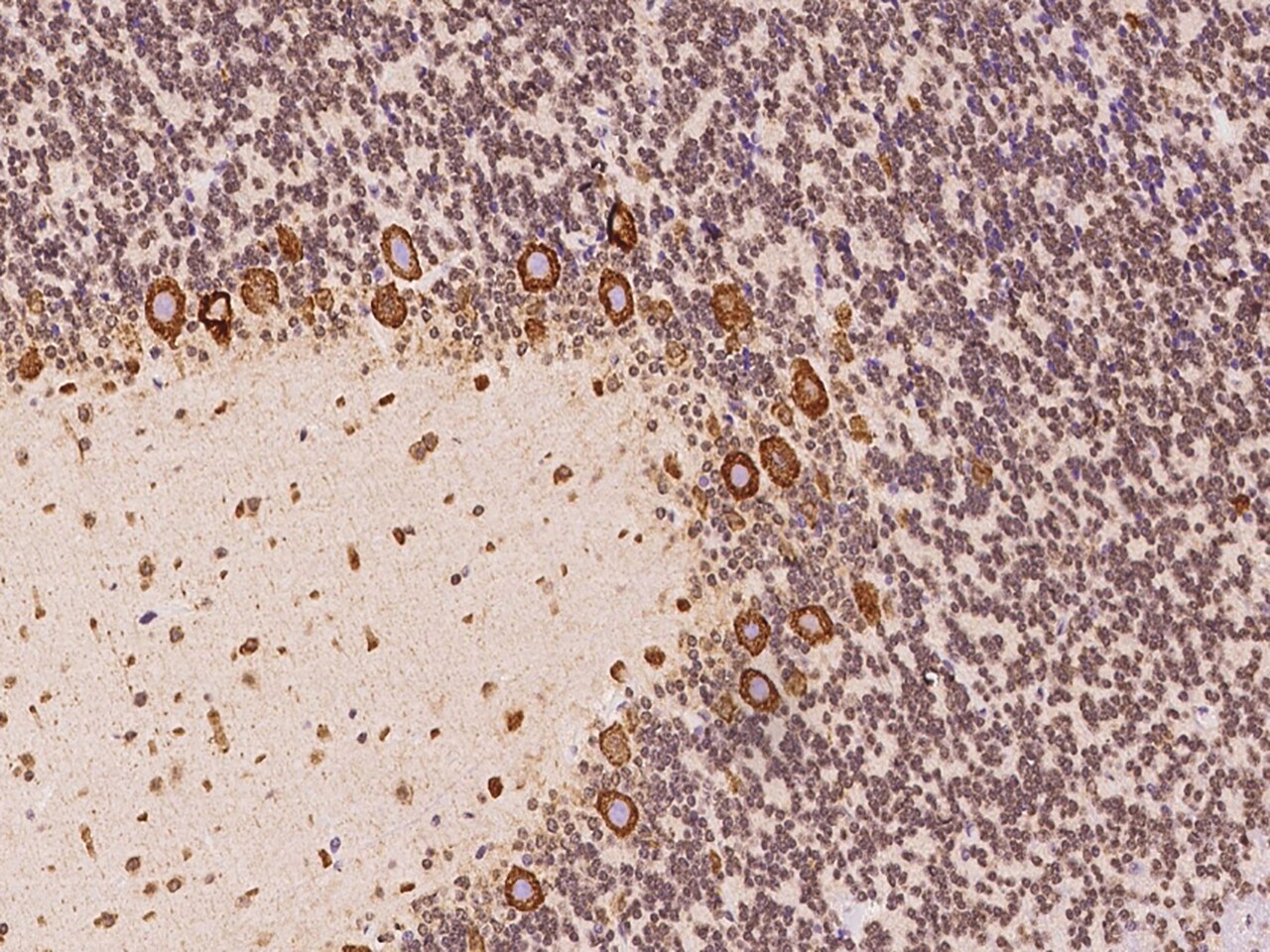 TMEM38A Antibody - BSA Free