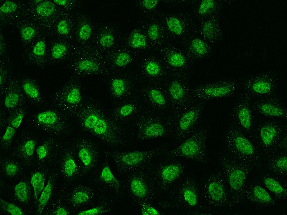 TMEM38A Antibody - BSA Free