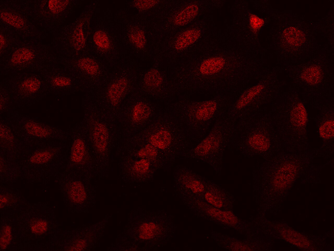 NCAPH Antibody - BSA Free