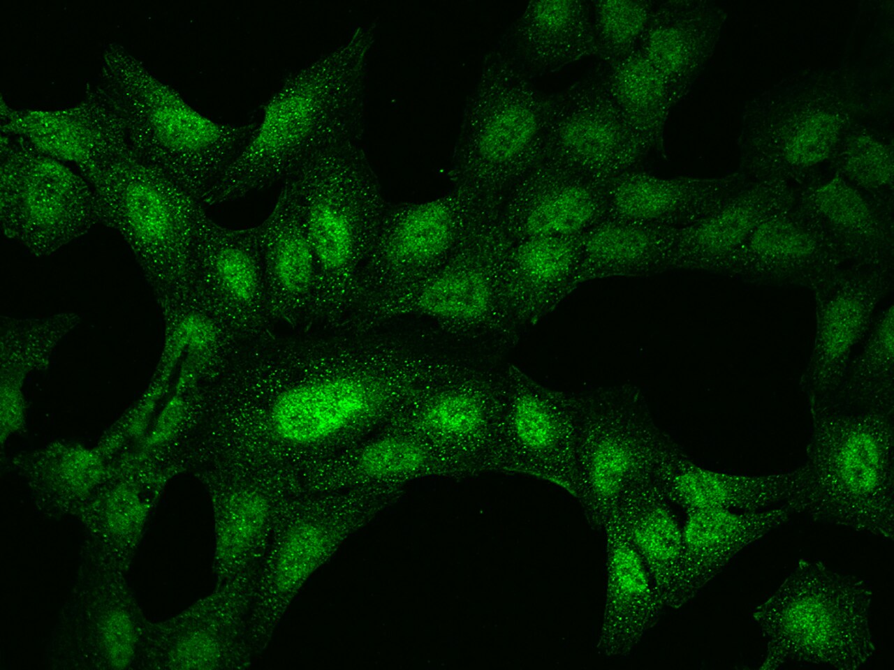TET1 Antibody - BSA Free