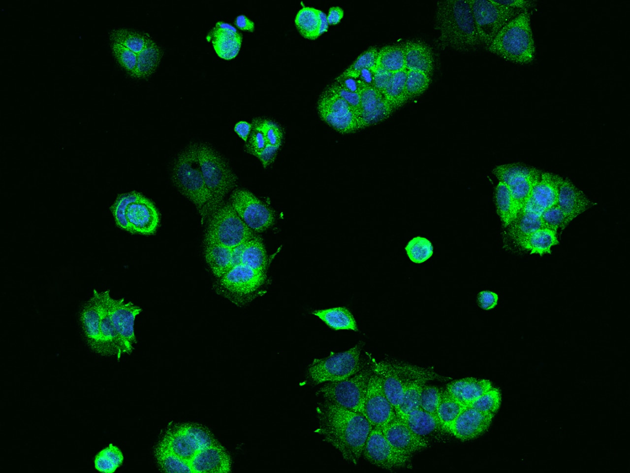 RPS10 Antibody - BSA Free