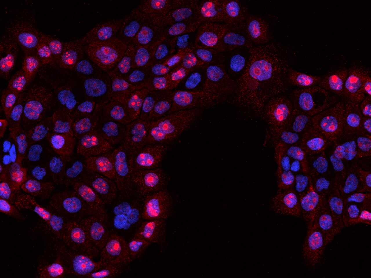 RSL1D1 Antibody - BSA Free