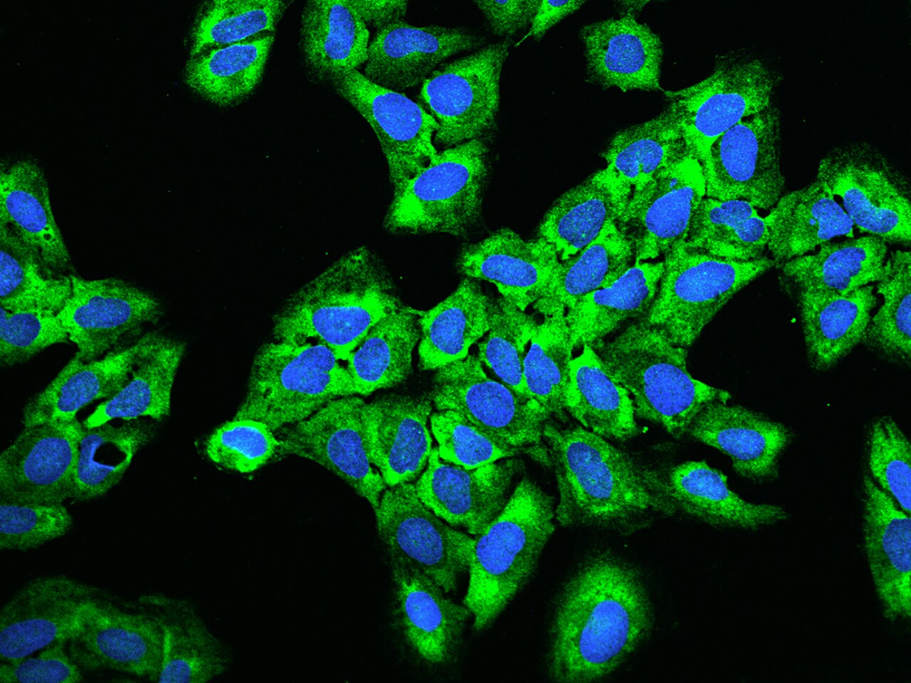 RPS5 Antibody - BSA Free