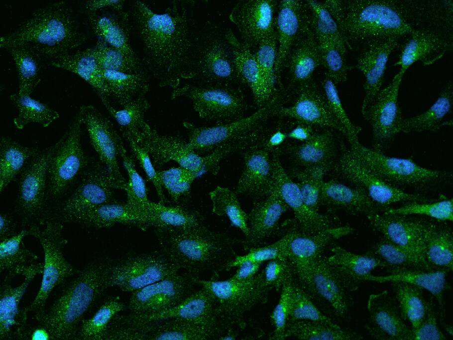 RABEP1 Antibody - BSA Free