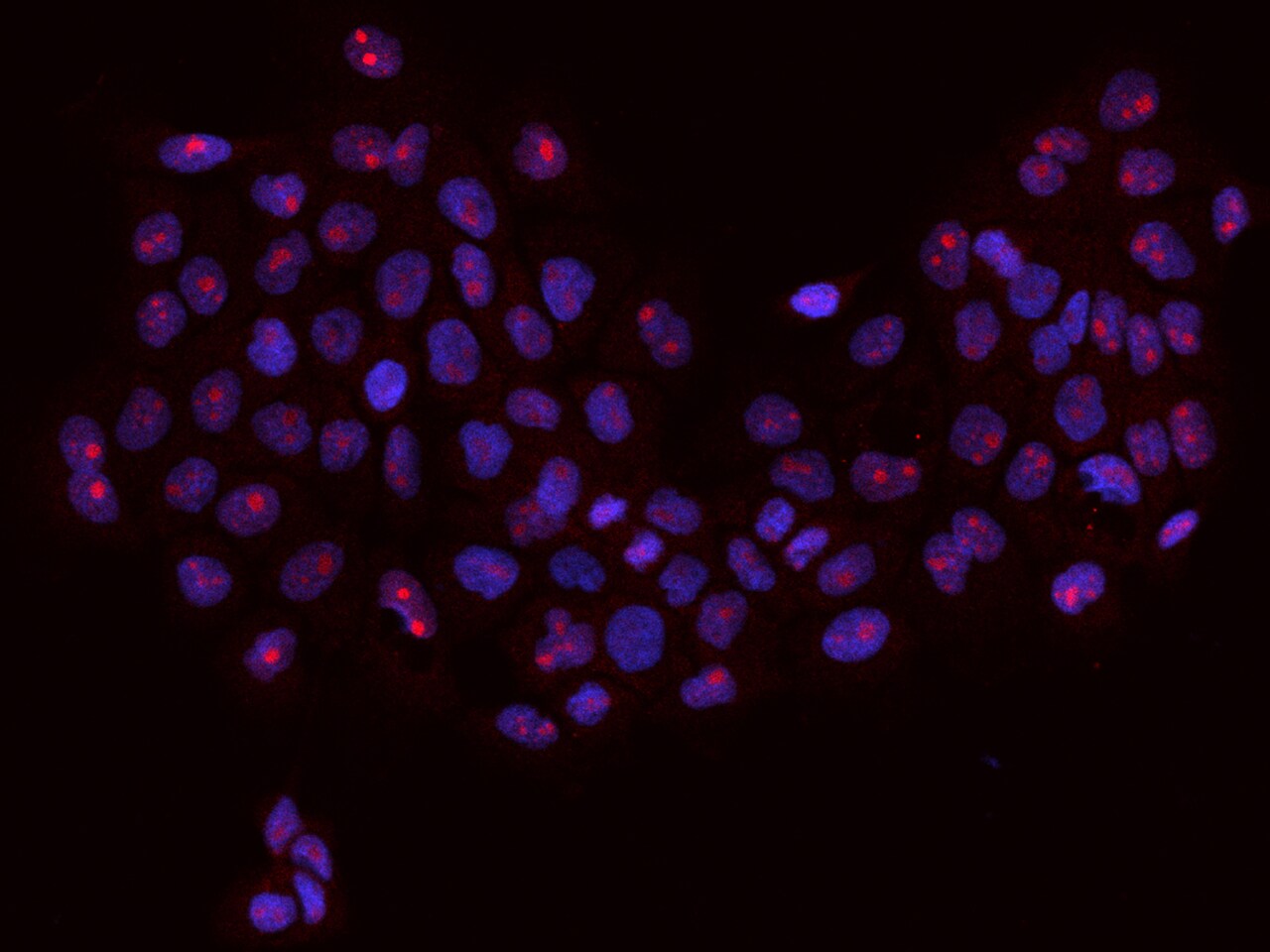 RBM34 Antibody - BSA Free