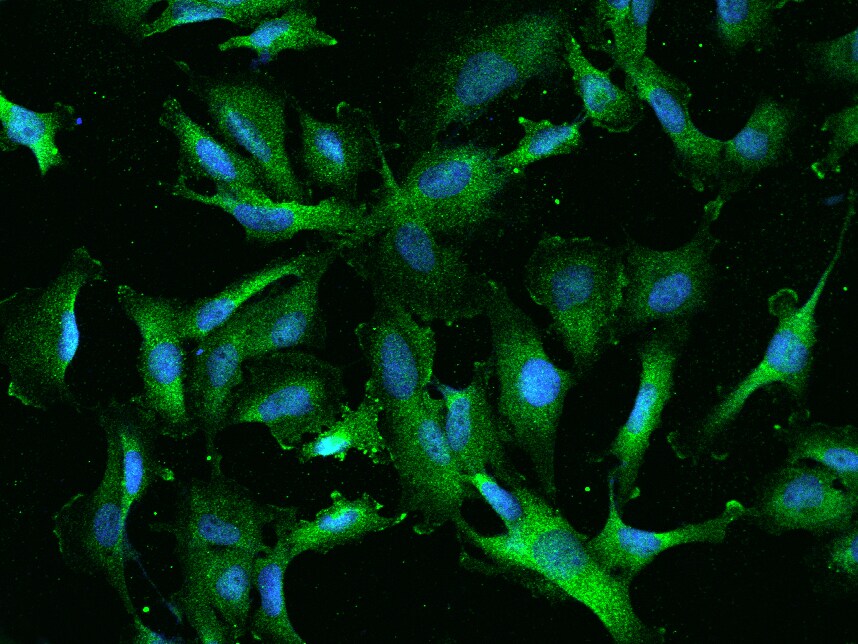 RIOK2 Antibody - BSA Free