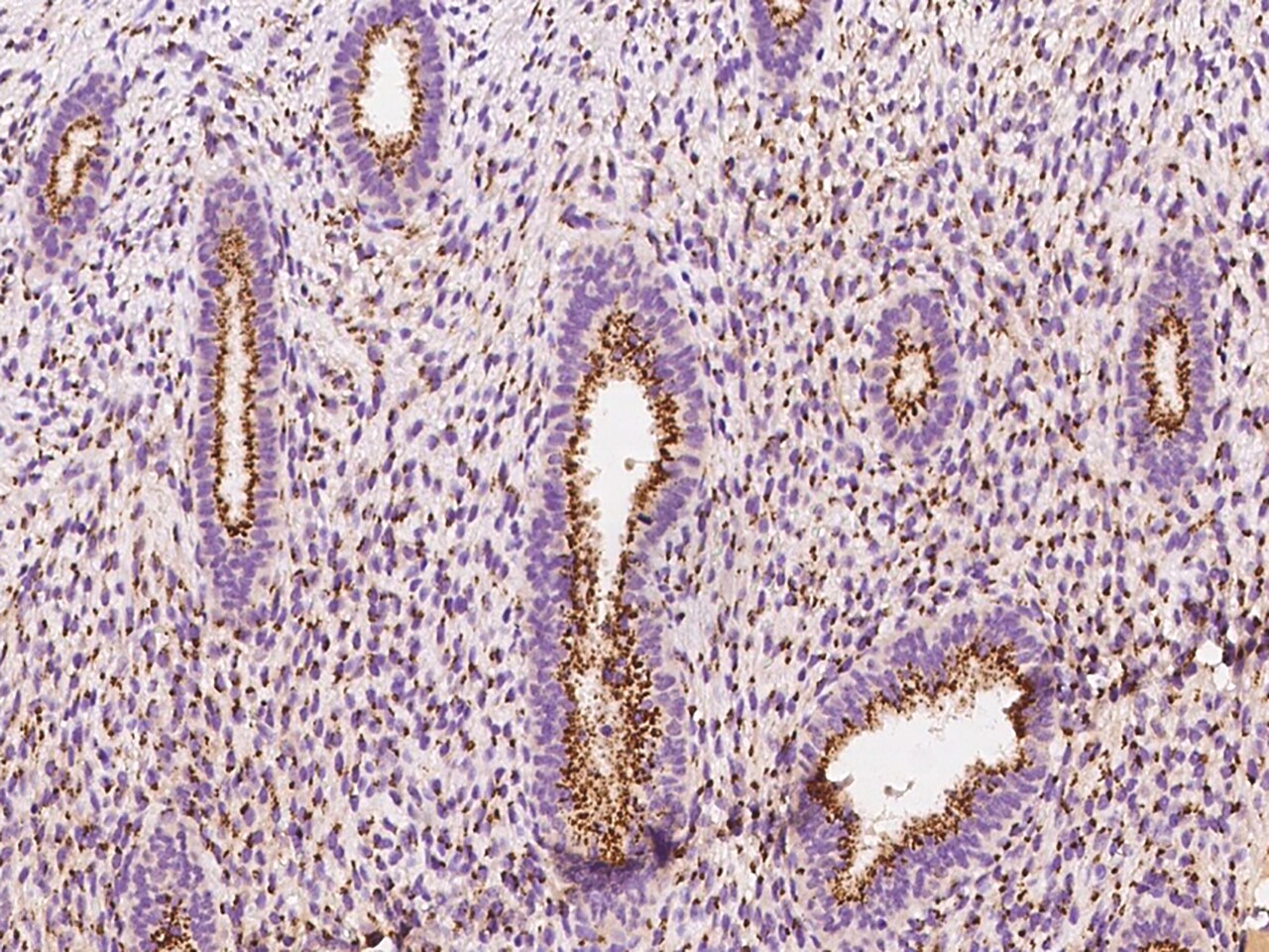 YIPF4 Antibody - BSA Free