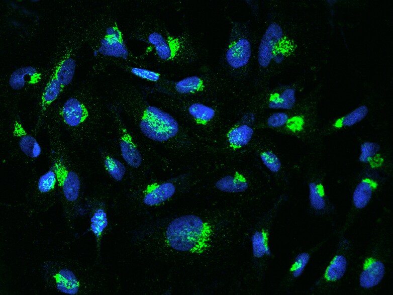 YIPF4 Antibody - BSA Free