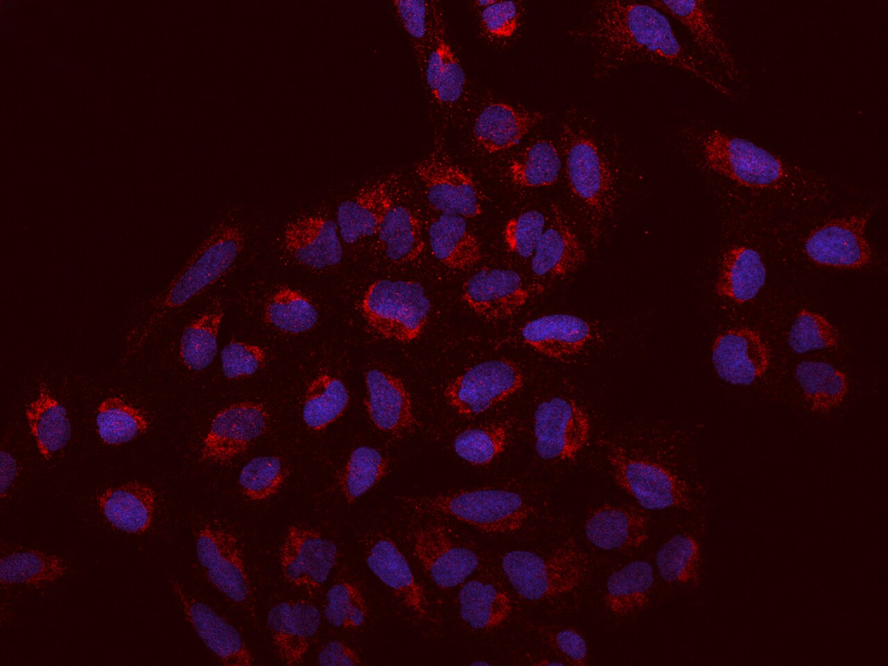 SACM1L Antibody - BSA Free