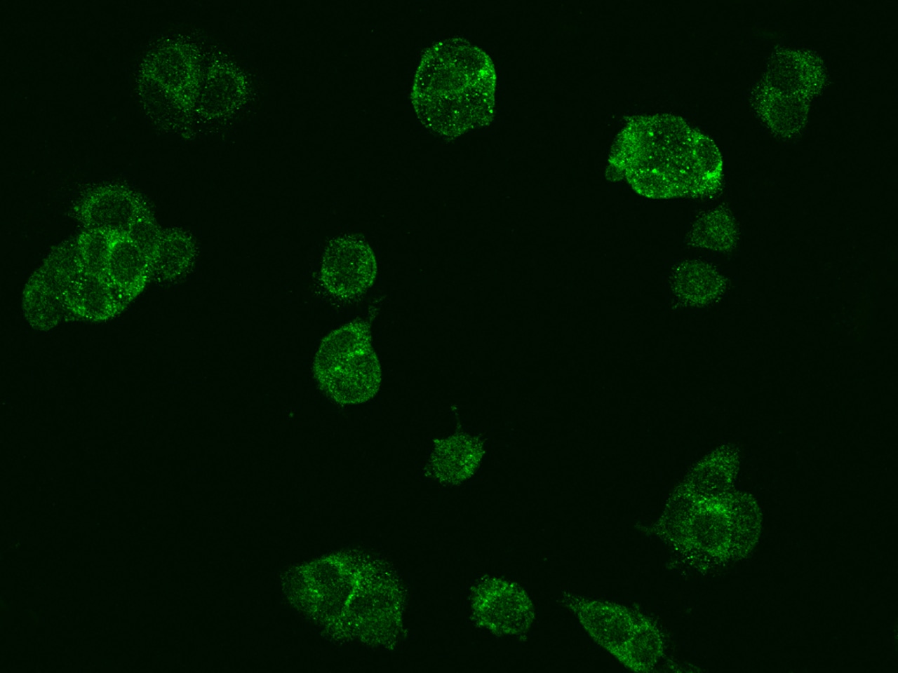SGSM3 Antibody - BSA Free