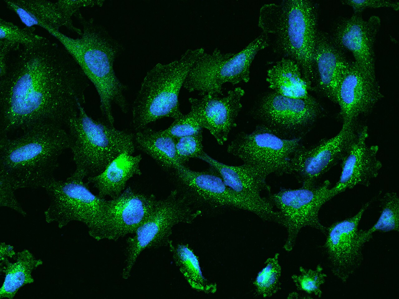 SLC26A2 Antibody - BSA Free