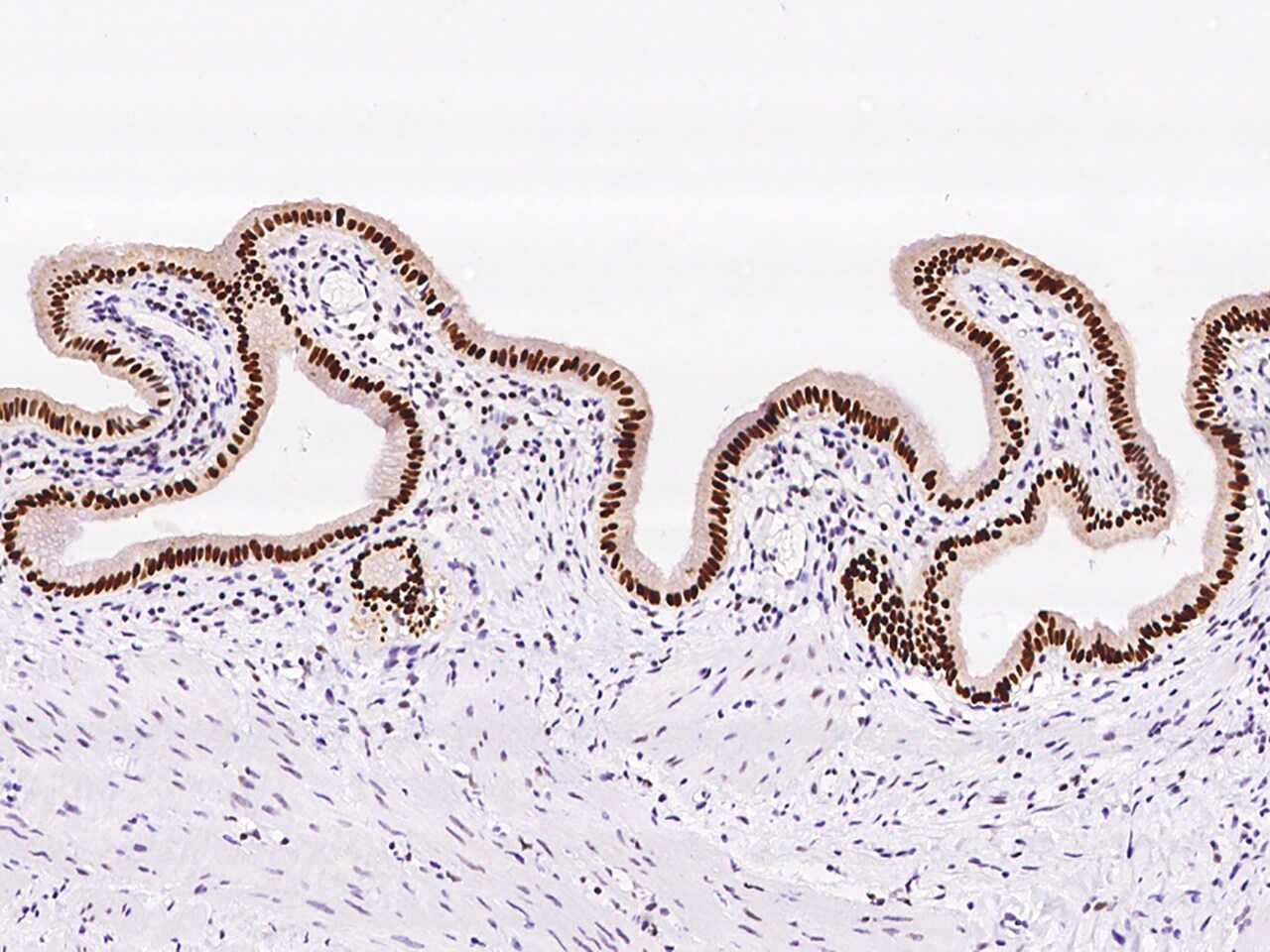 PAPSS1 Antibody - BSA Free
