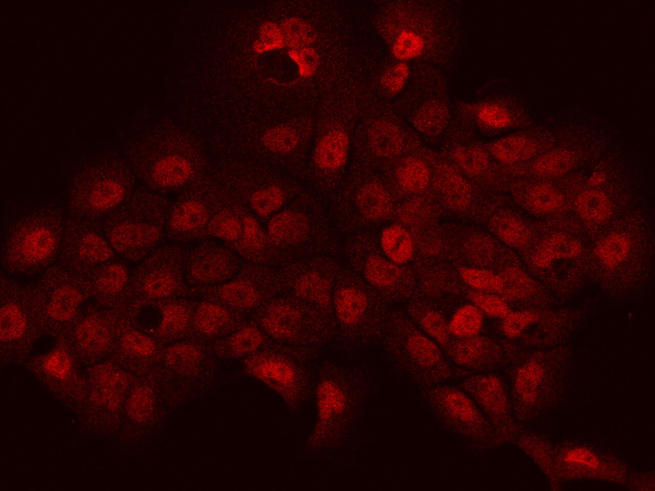 PHTF2 Antibody - BSA Free
