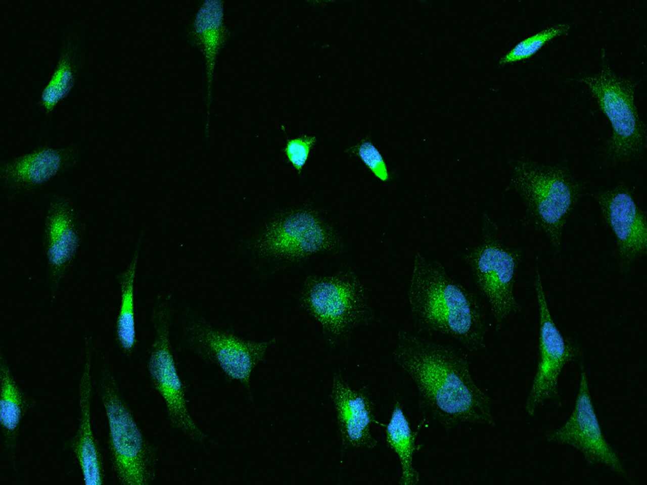 Glucose 1-dehydrogenase Antibody - BSA Free