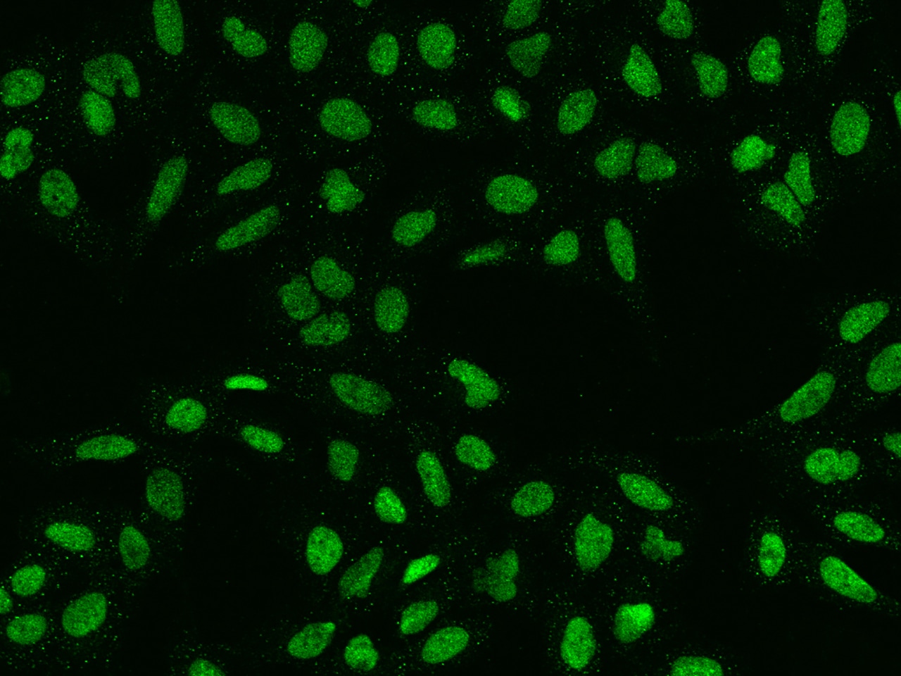 HMG20A Antibody - BSA Free