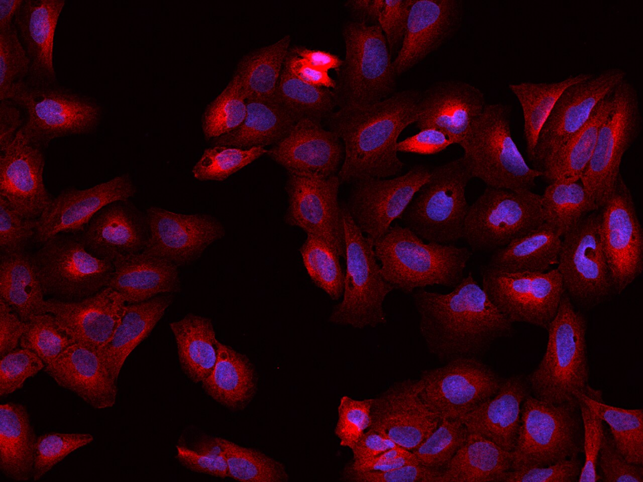 CRMP2 Antibody - BSA Free