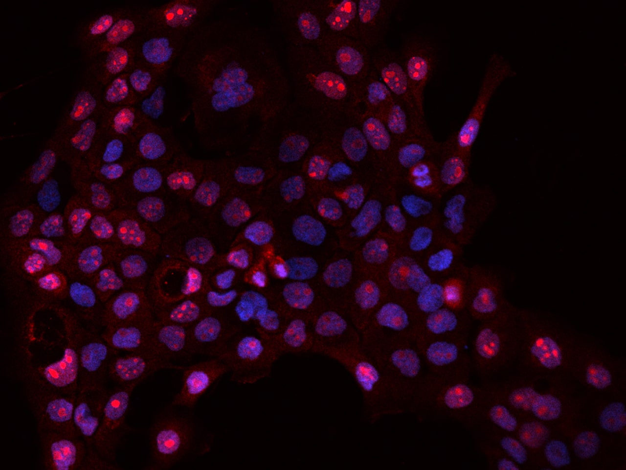 DNTTIP2 Antibody - BSA Free