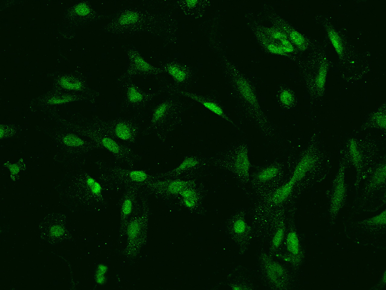 TOP2B Antibody - BSA Free