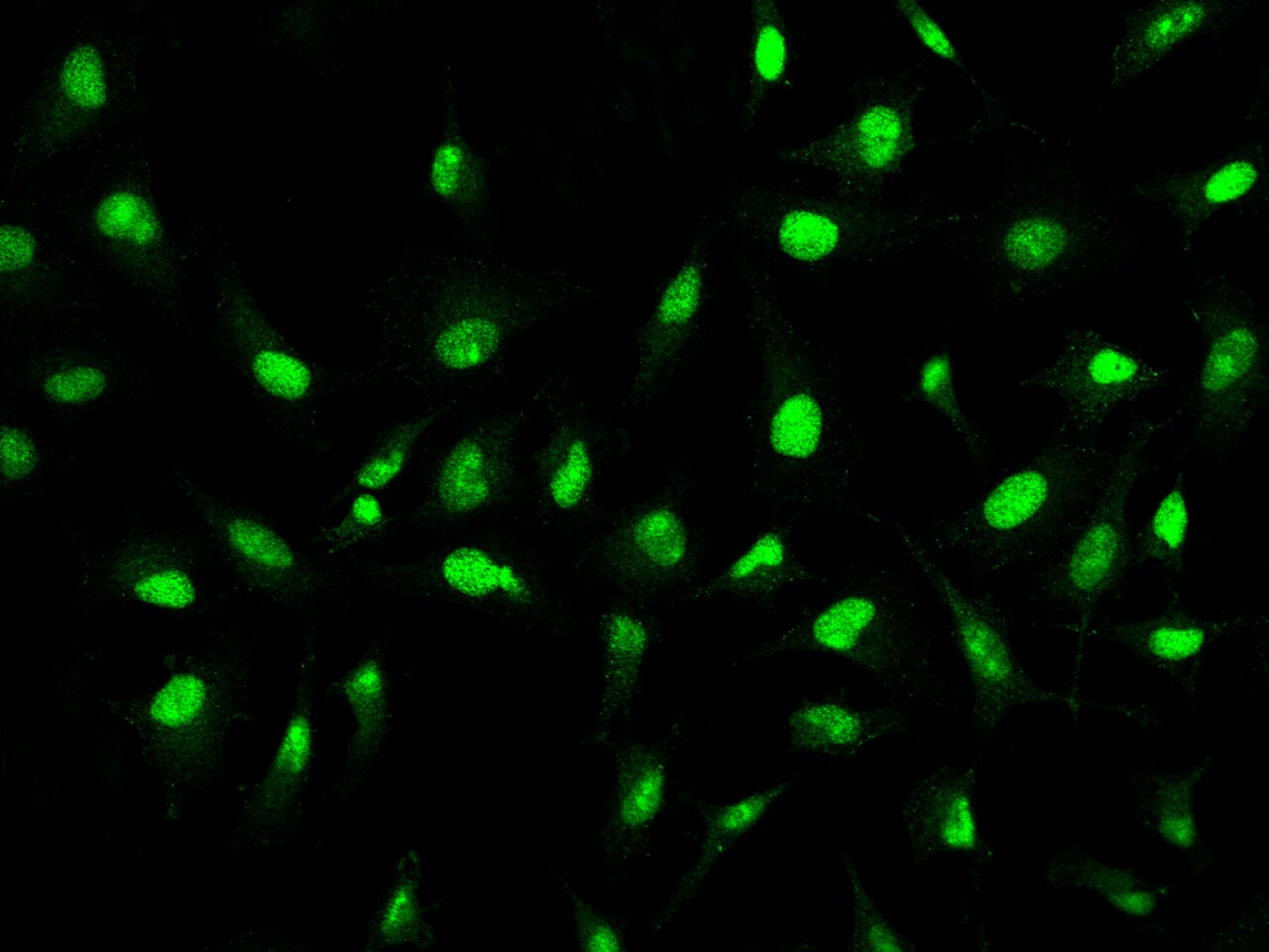 ZCCHC9 Antibody - BSA Free