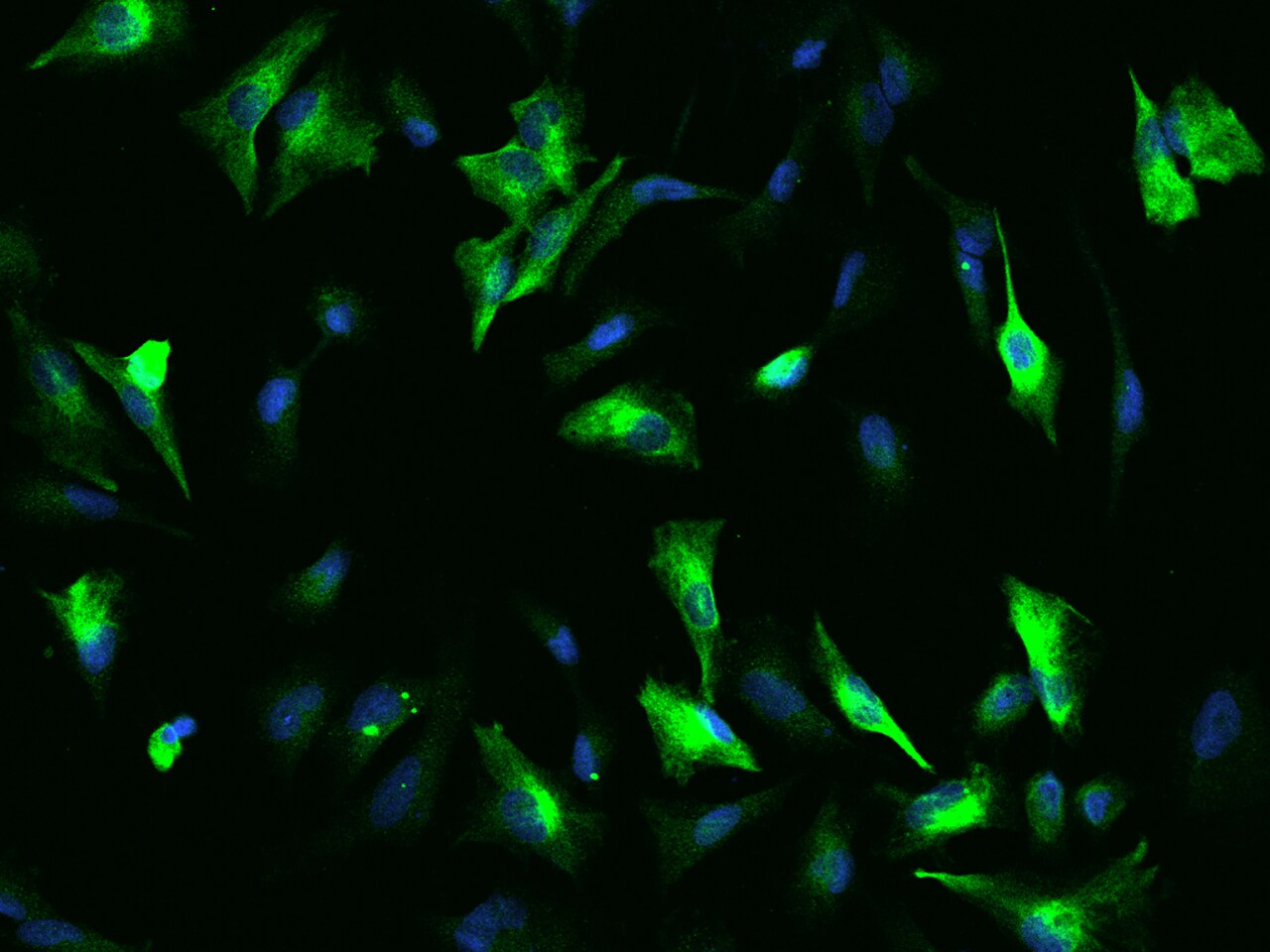 OTUD7B/Cezanne/ZA20D1 Antibody - BSA Free