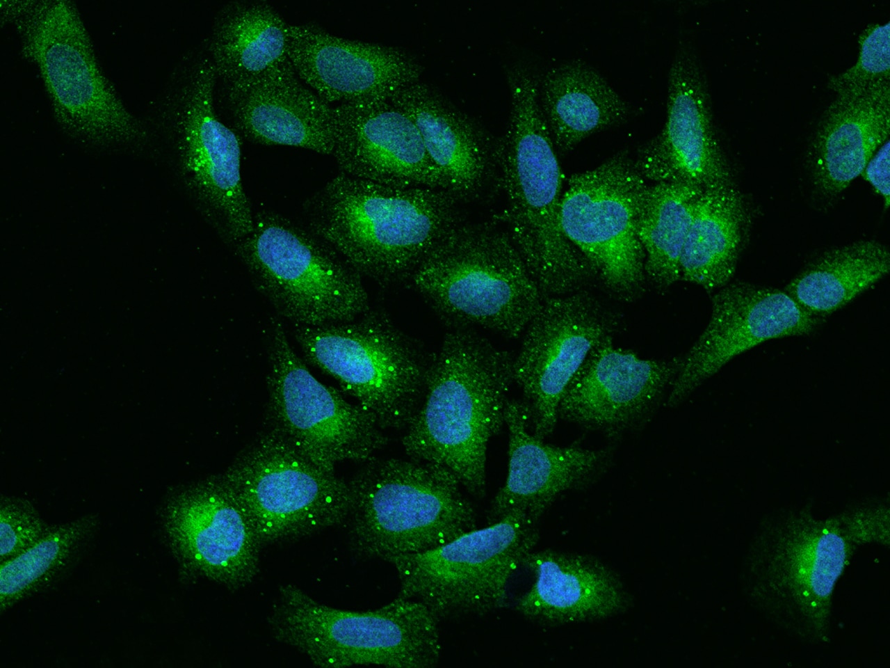 VAP-A Antibody - BSA Free