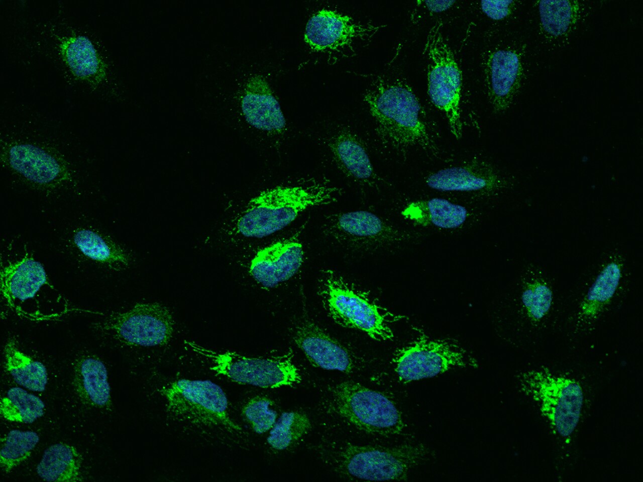 NDUFB5 Antibody - BSA Free
